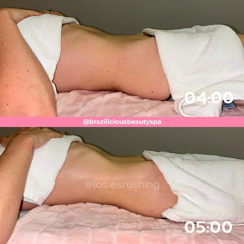 Before and after - Body