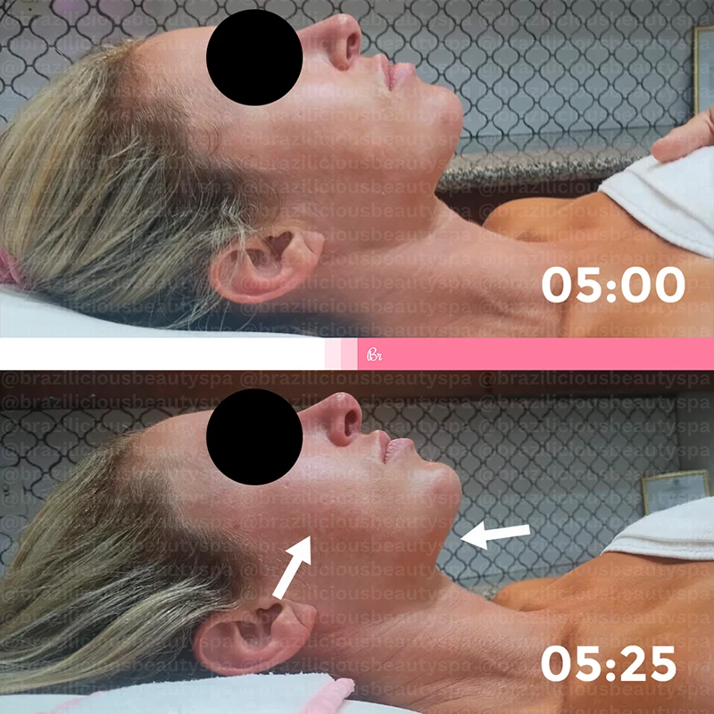 Feed-1-Face-copiar.webp