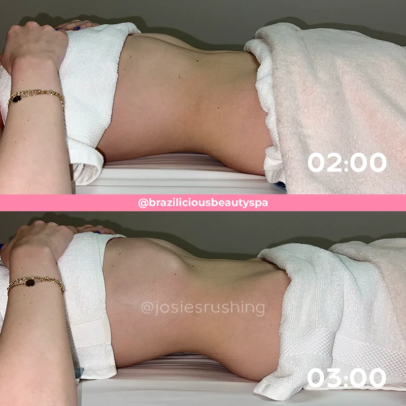 Before and after - Body