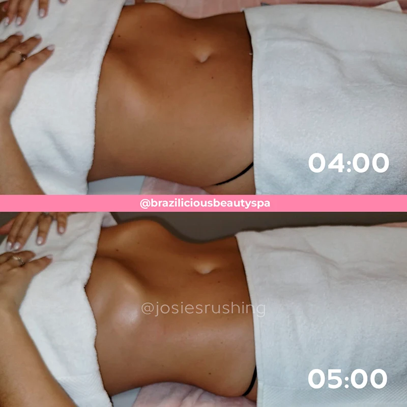 Before and after - Body