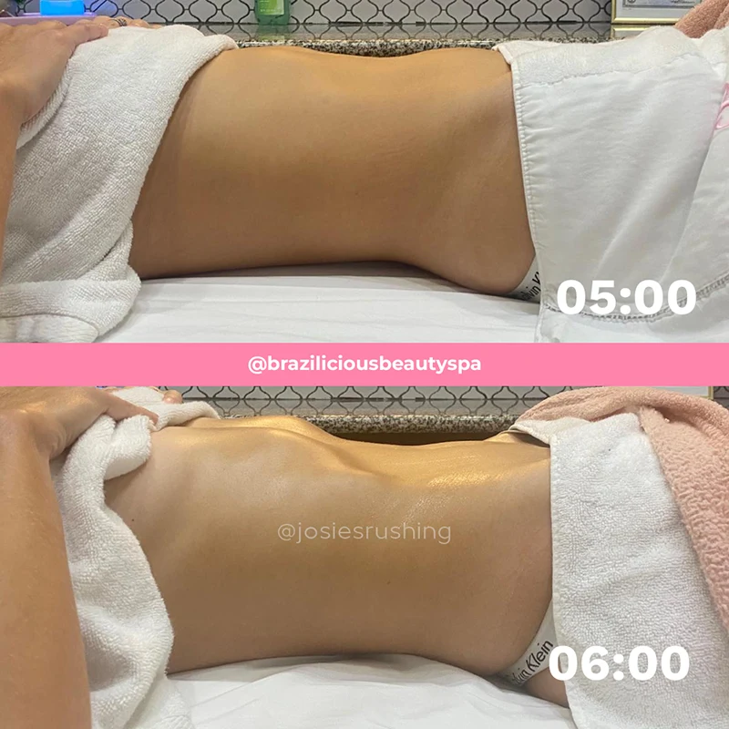Before and after - Body