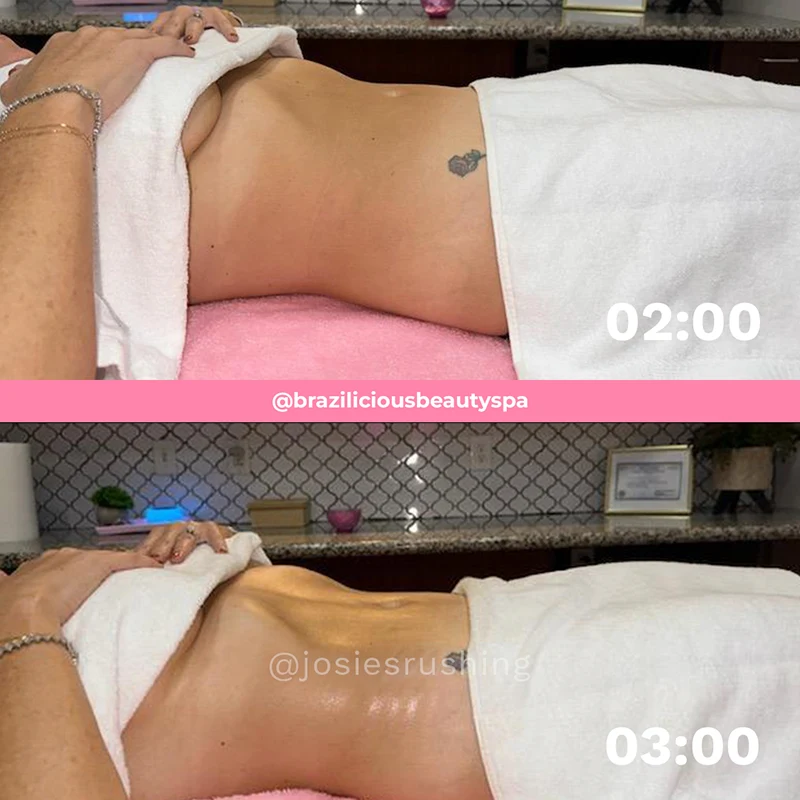 Before and after - Body