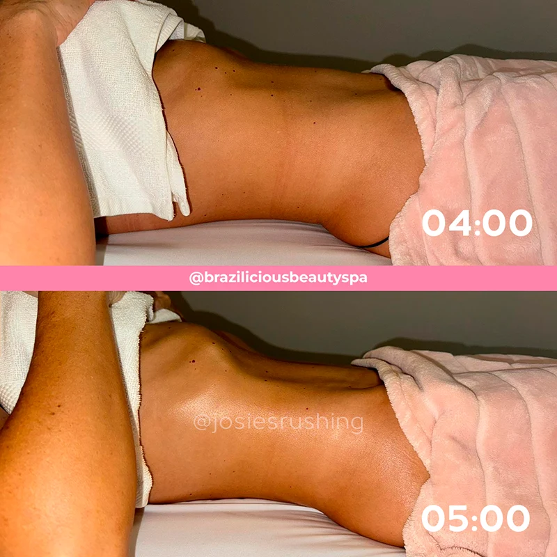Before and after - Body
