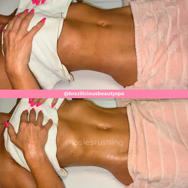 Before and after - Body