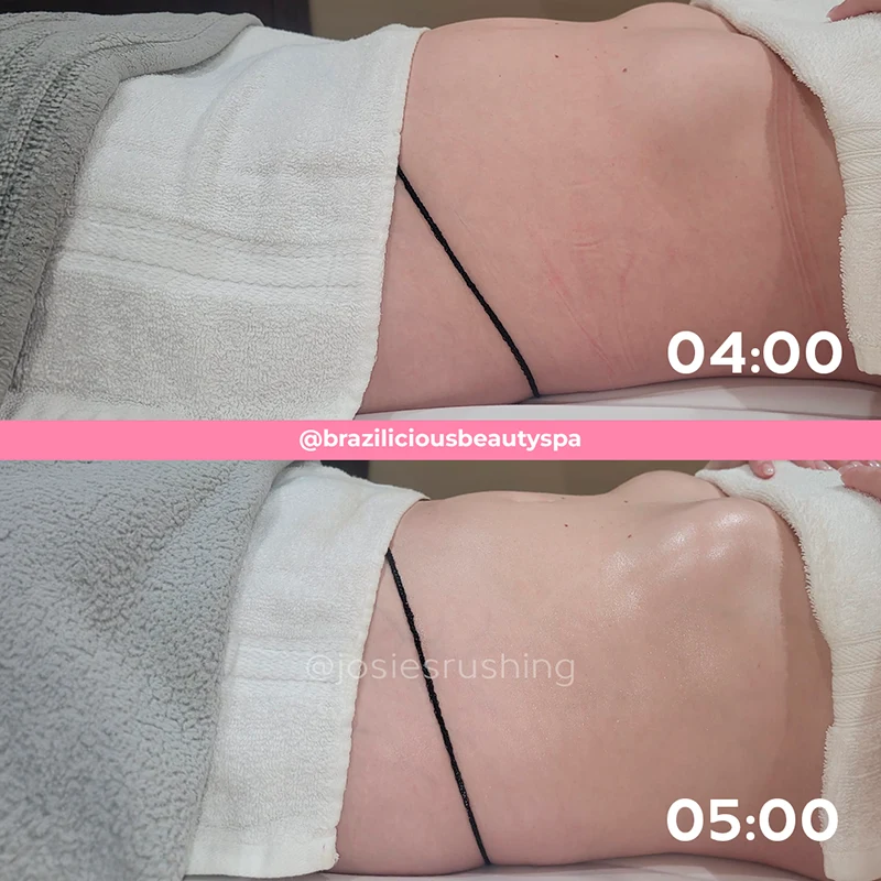 Before and after - Body