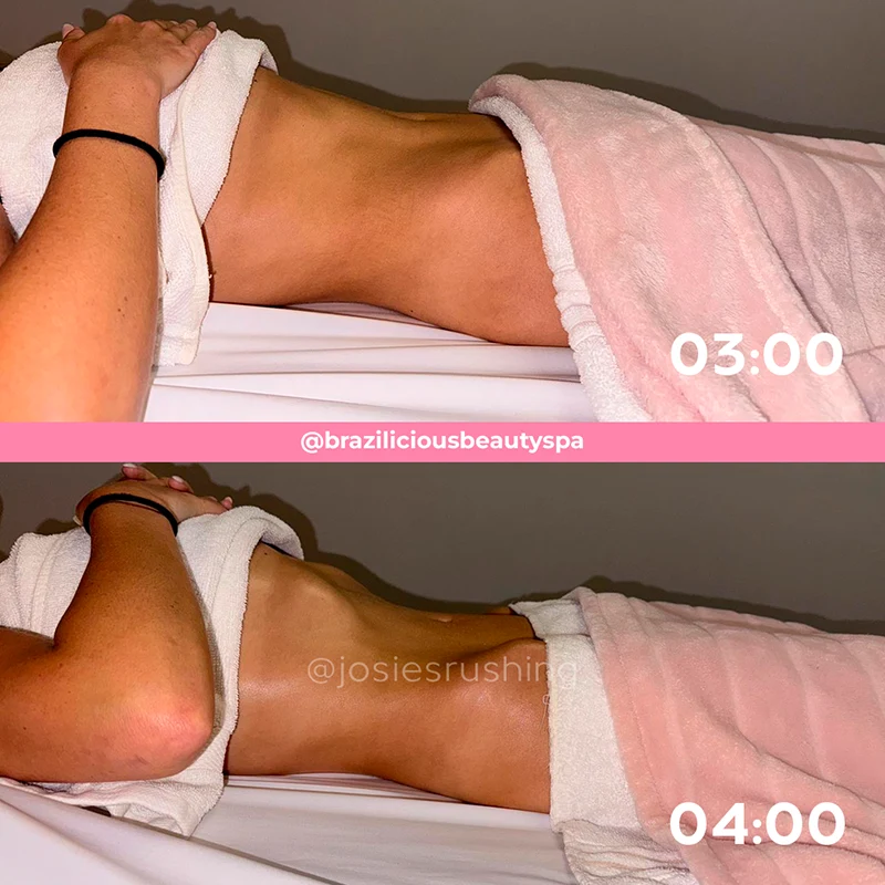 Before and after - Body