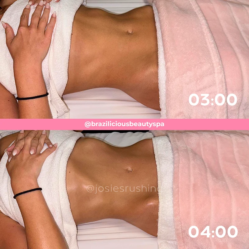 Before and after - Body